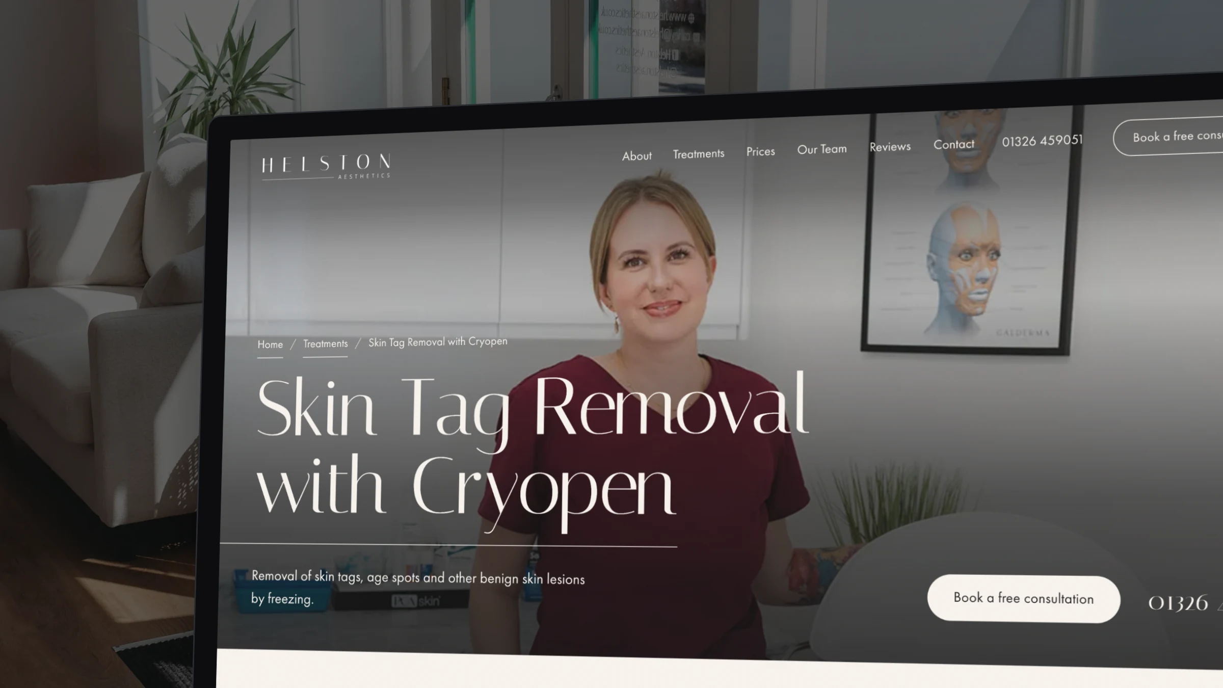 The Skin Tag Removal with Cryopen page on a laptop