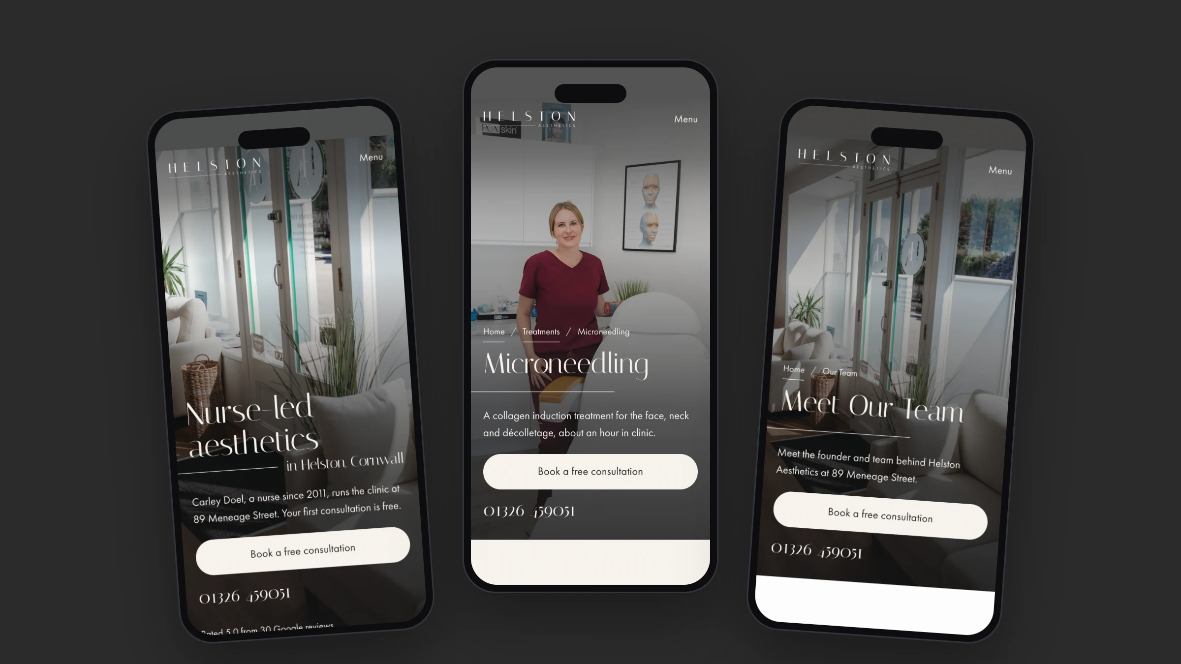 The homepage, the Microneedling page and the Meet Our Team page on phones
